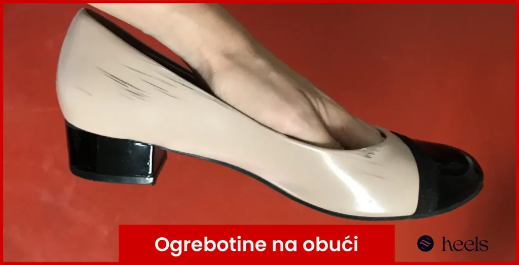 Ogrebotine na obući